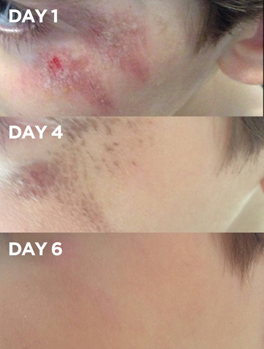 Golden Dry Skin Miracle Salve